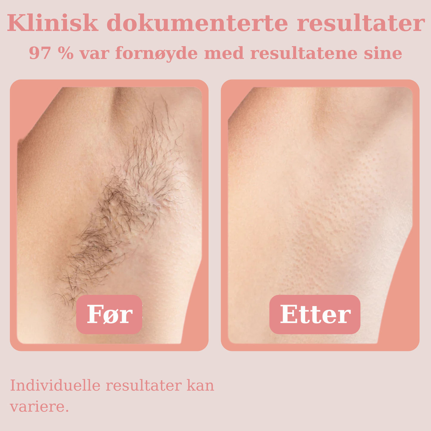 Hårfjerningsolje av Eterna